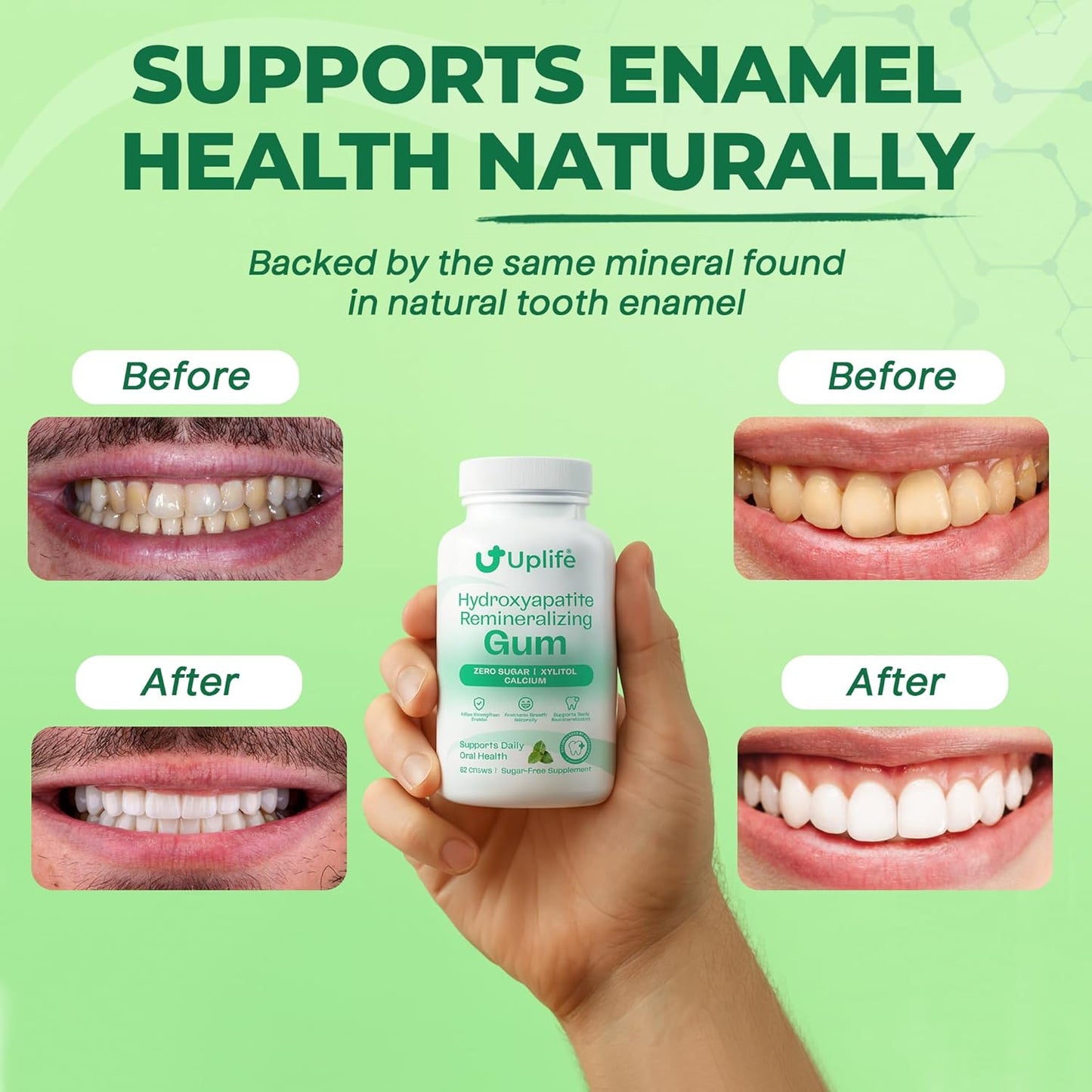 Uplife Hydroxyapatite Remineralizing Gum (62pcs)